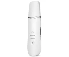 Ultrasonic Rechargeable Face Skin Scrubber Facial Cleaning Blackhead Removal Cleaner  - Milk White