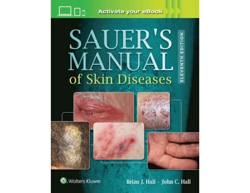 Sauer's Manual of Skin Diseases - Hardback