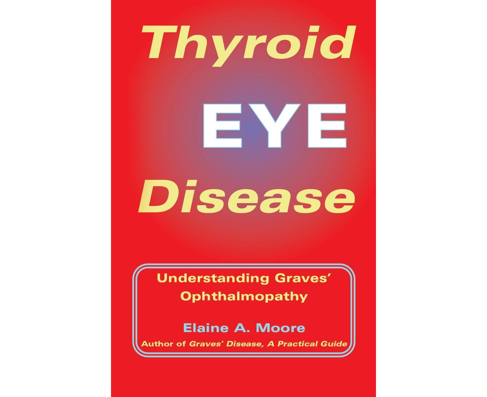 thyroid-eye-disease-encyclopedia-mdpi