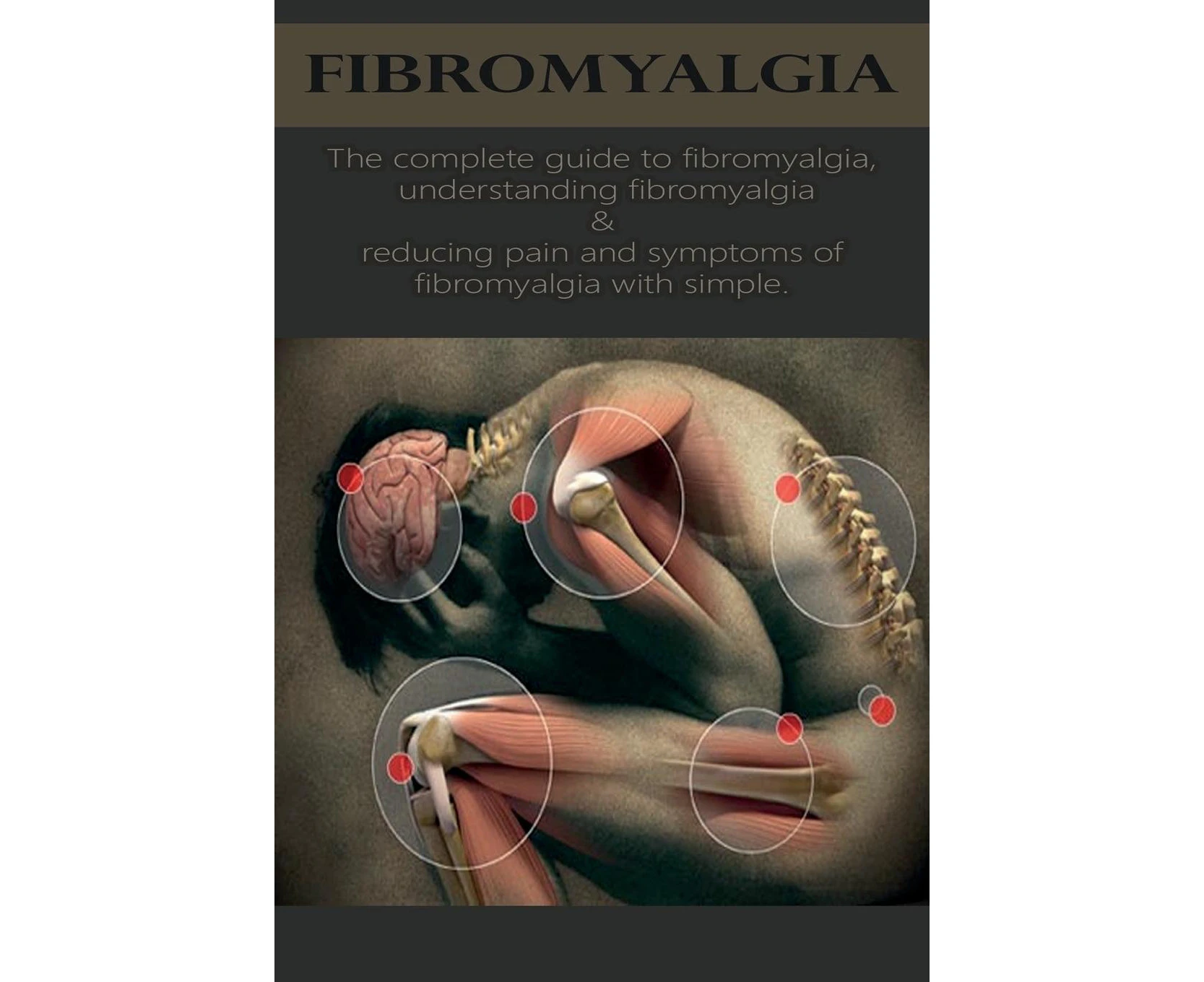 Fibromyalgia