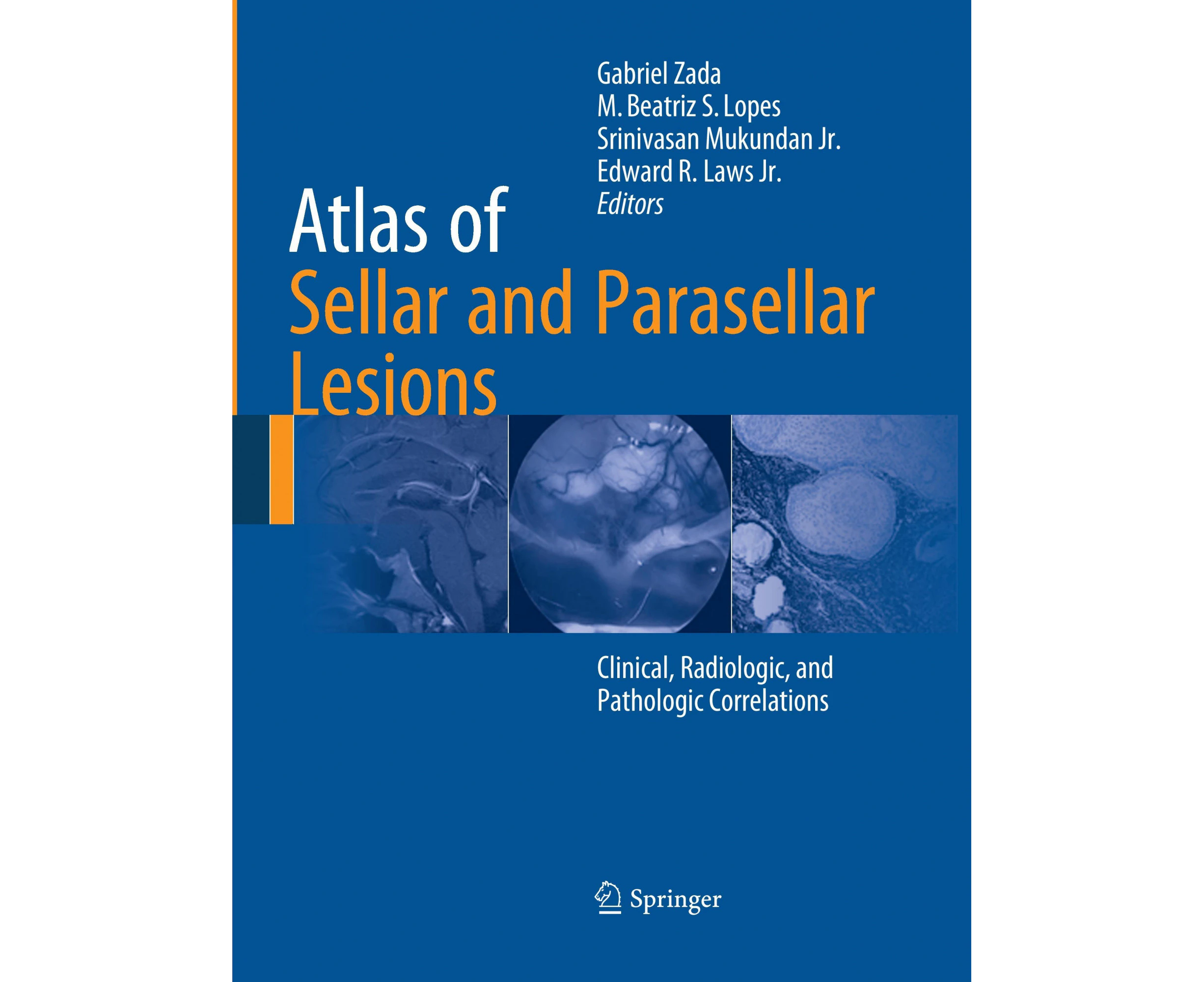 Atlas of Sellar and Parasellar Lesions: Clinical, Radiologic, and Pathologic Correlations