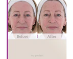 My Perfect Facial 10 Treatments