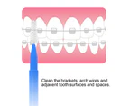 30Pcs/Box Interdental Brush Soft Bristle Teeth Care Manual Orthodontic Dental Teeth Brush Toothpick Oral Care-Blue