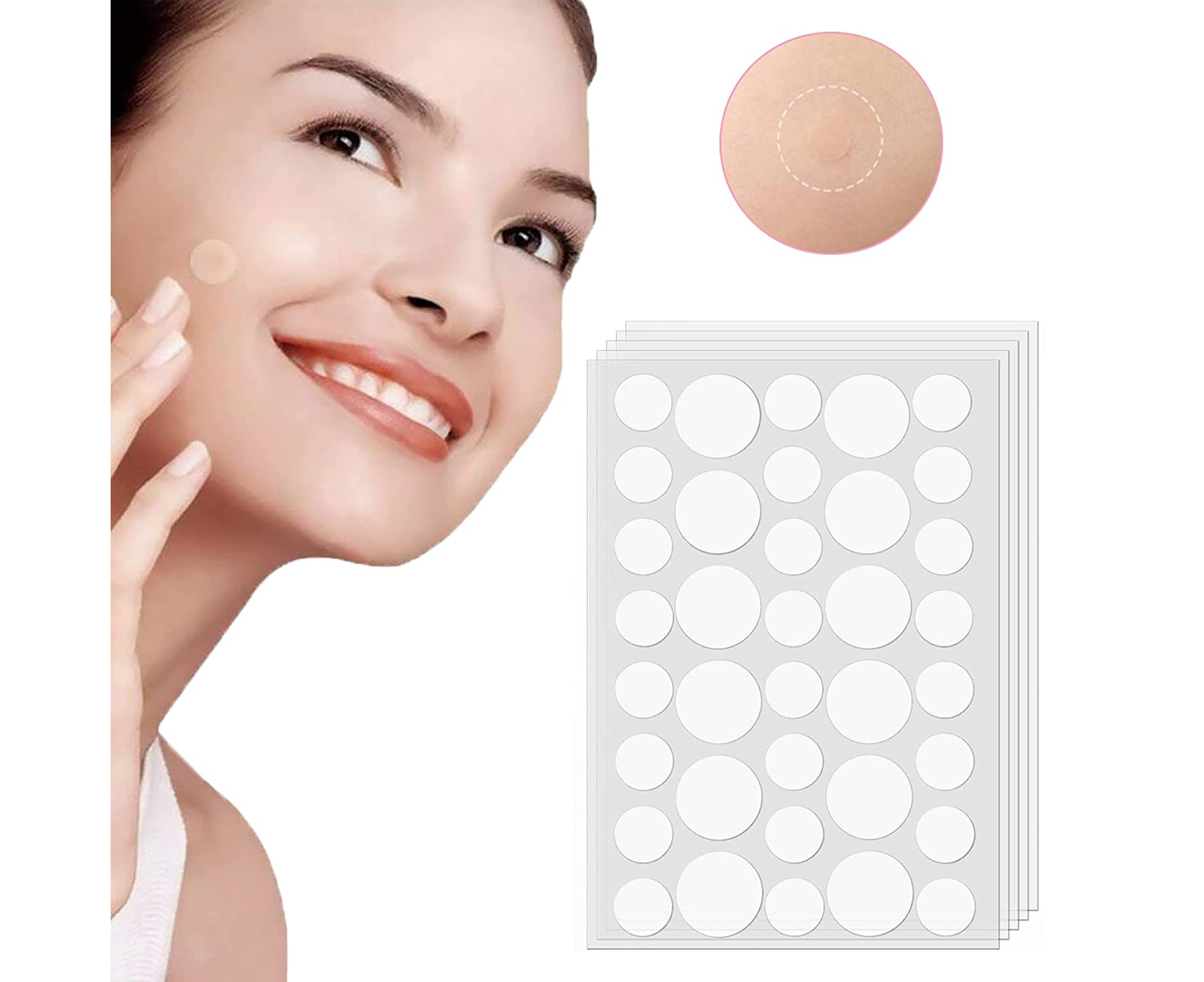 rpanle-acne-pimple-master-patch-hydrocolloid-acne-pimple-patch-180