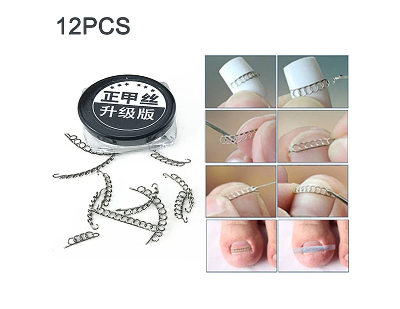 12Pcs Ingrown Toe Nail Correction Wire Pedicure Toenail Corrector Foot Care Tool