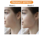 Jaw Exerciser To Reduce Double Chin, Enhance & Define Your Jaw