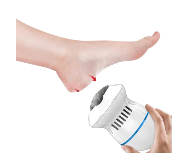 Foot Callus Remover With Built-In Vacuum