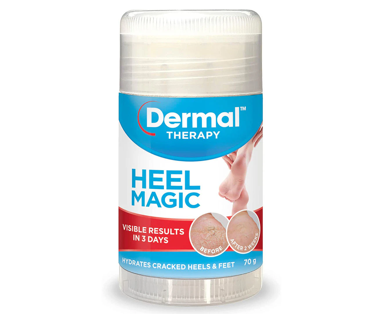 Dermal Therapy Heel Magic 70g