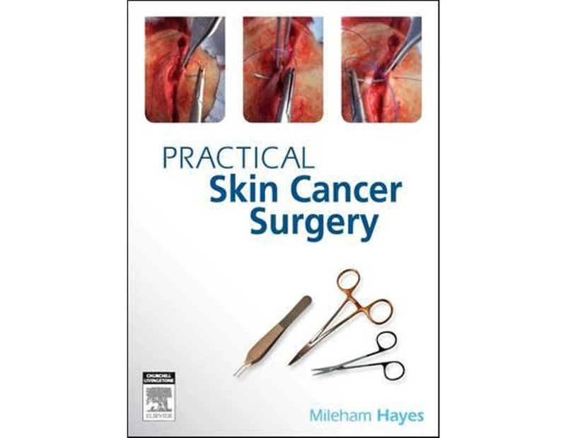 Practical Skin Cancer Surgery