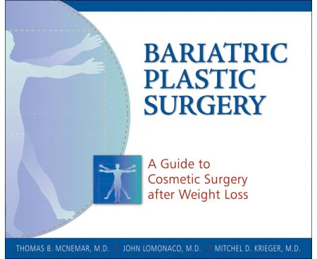 Bariatric Plastic Surgery - Paperback