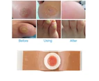 Foot Corn Remover Pads Plantar Wart Thorn Plaster Patch Callus Removal - 10 pcs