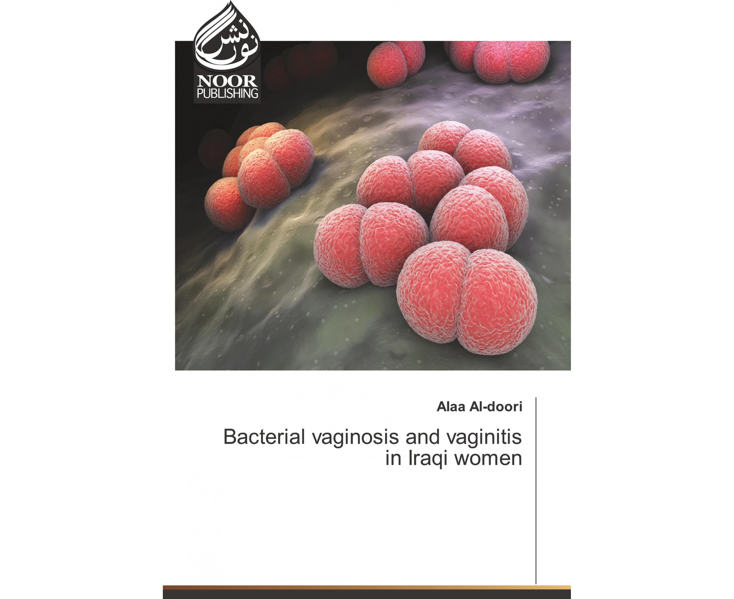 Bacterial vaginosis and vaginitis in Iraqi women