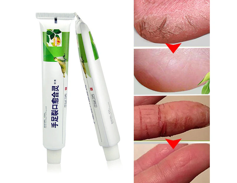 Powerful Hand Foot Crack Cream Heel Chapped Peeling Skin Care Chinese Ointment