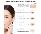 216 Dots Invisible Acne Pimple Master Patch Acne Patch Face Scar Care Treatment Stickers(6 Sheet) - White