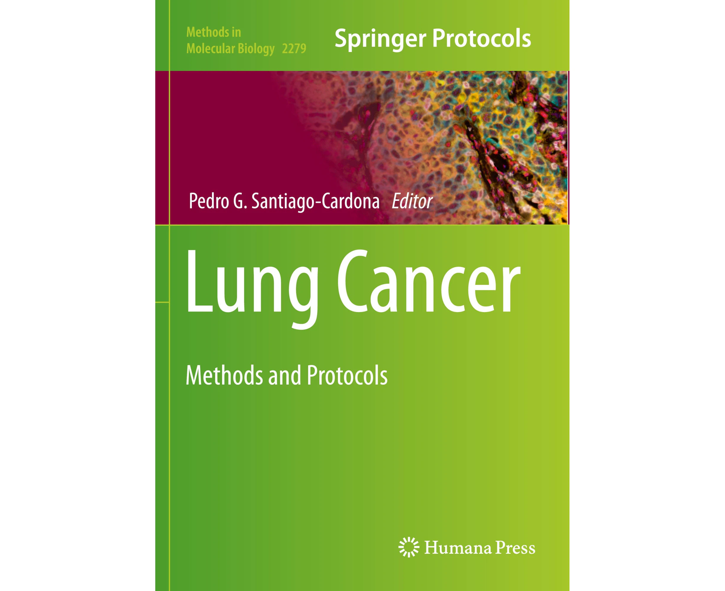 Lung Cancer: Methods and Protocols (Methods in Molecular Biology)