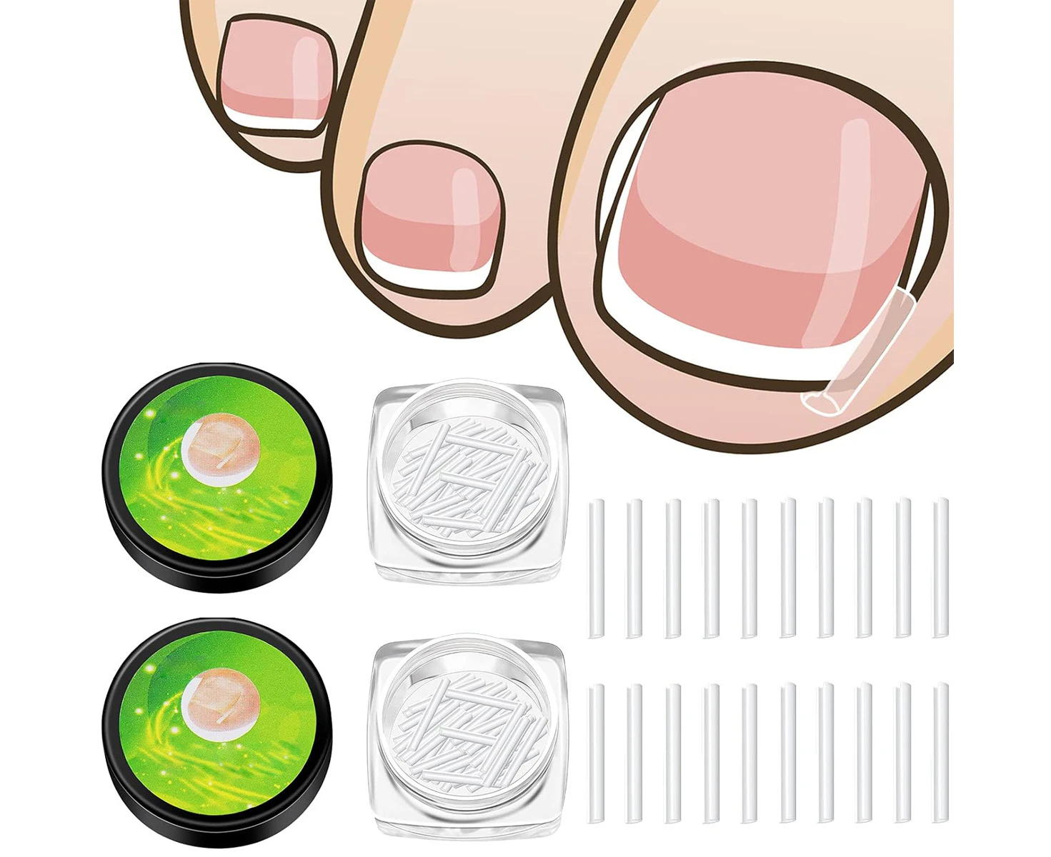 50/100 Pcs Ingrown Toenail Corrector Strips Toenail Correction Patches Curved Toenails Straightening Recover Clips for Men Women Foot Care