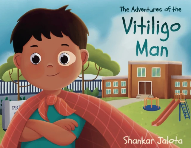 The Adventures of The Vitiligo Man by Shankar Jalota