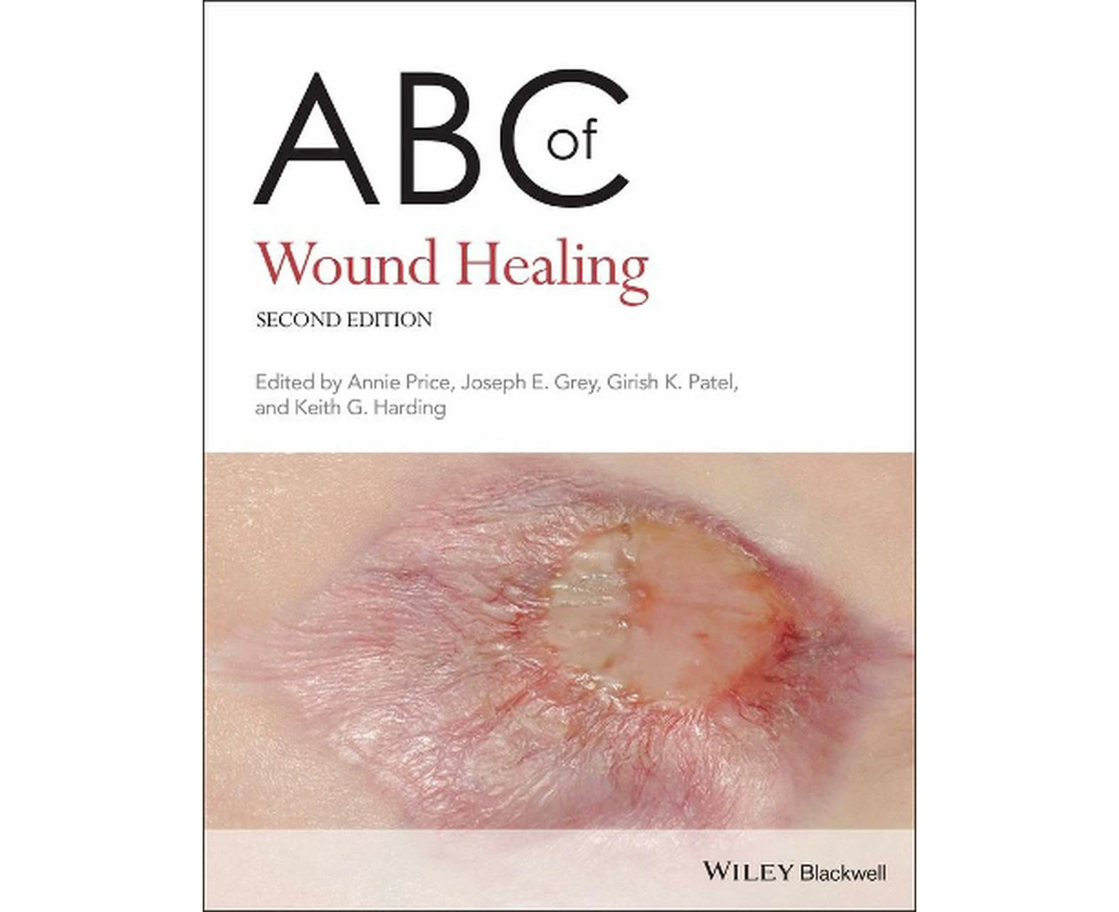 ABC of Wound Healing