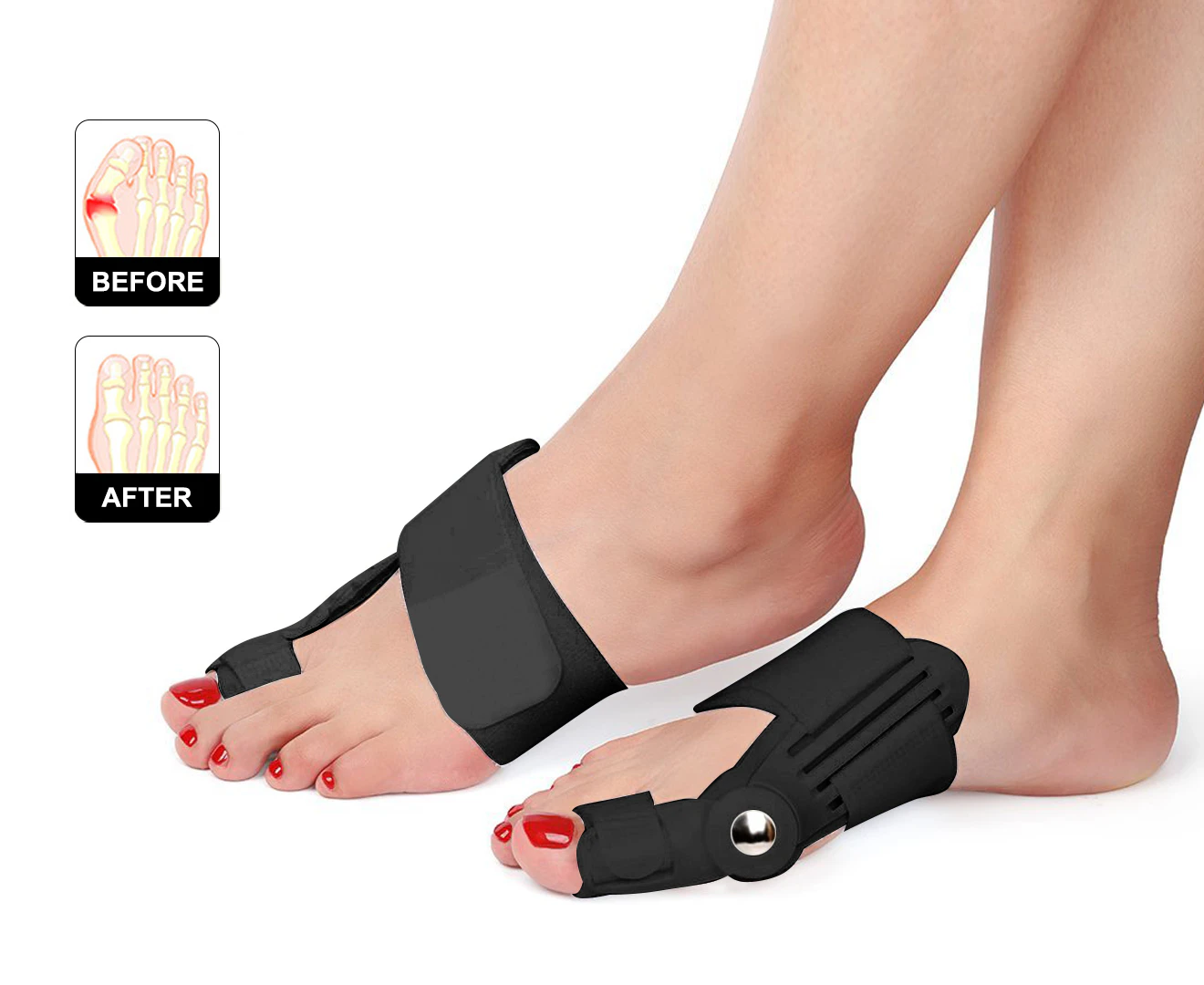 2pcs Tailors Bunion Corrector, Bunion Splint, Foot Hallux Big Toe Valgus Corrector Adjustable-Black