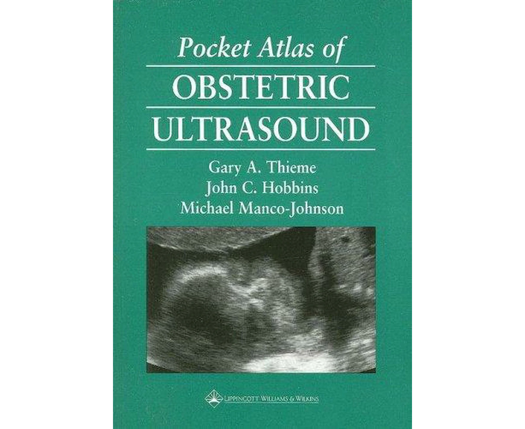 Pocket Atlas of Obstetric Ultrasound