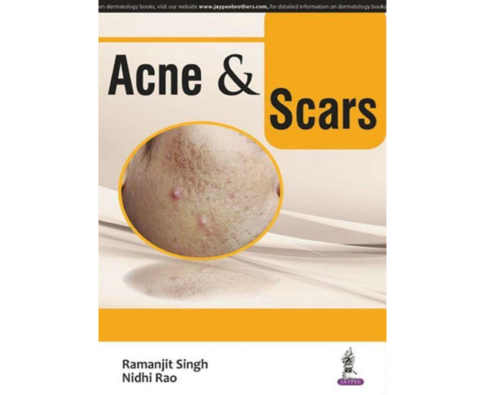 Acne & Scars