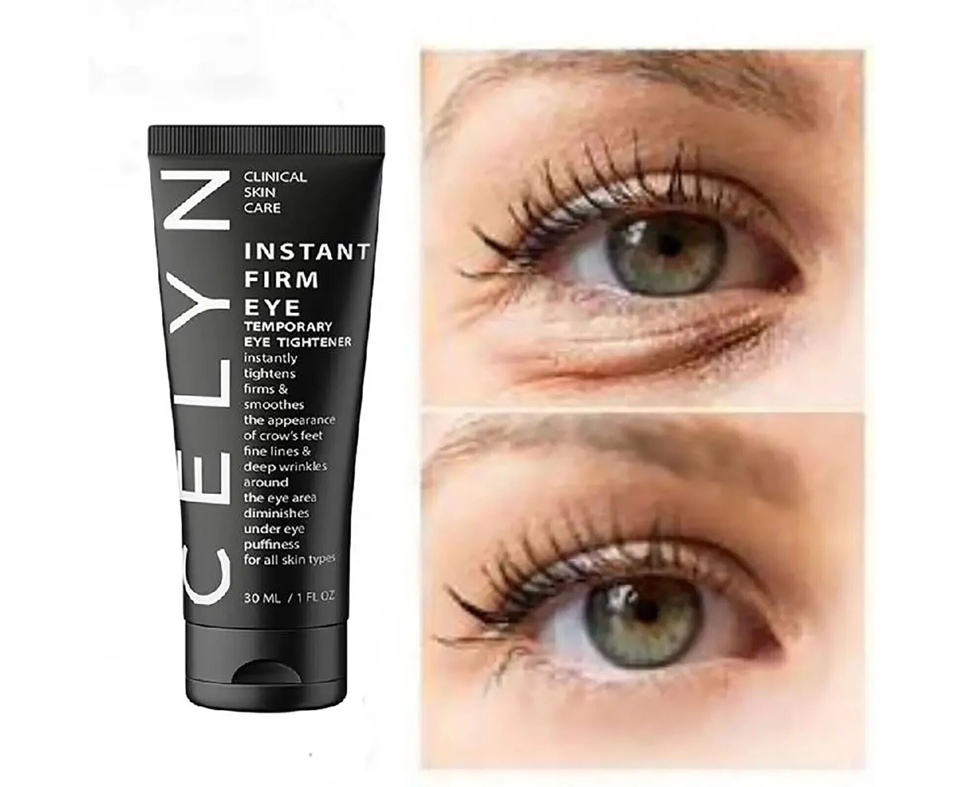 Best Celyn Eye Bag Cream 30ml Celyn Instant Firm Eye Tightener