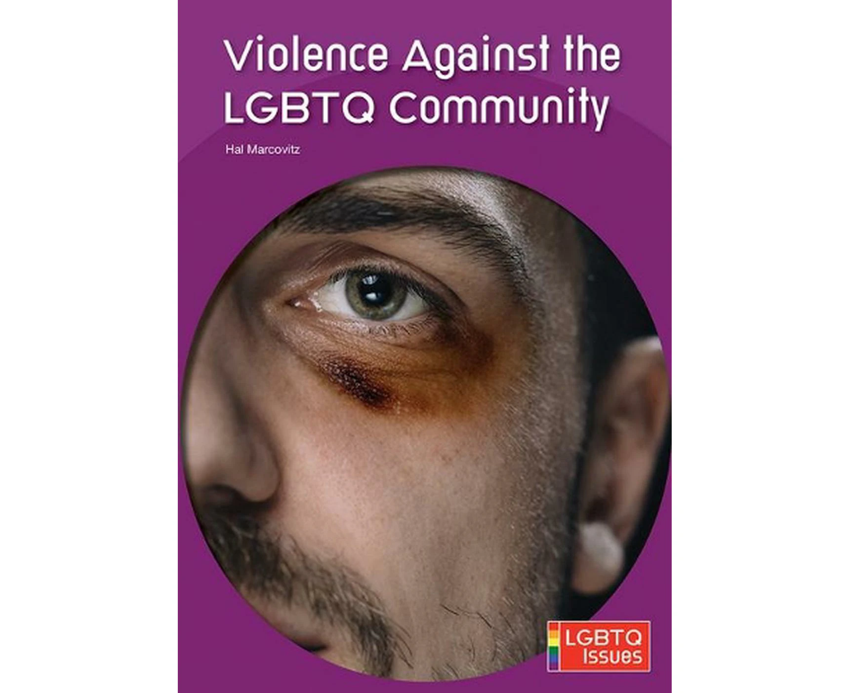 Violence Against the LGBTQ Community