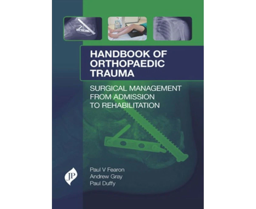 Handbook of Orthopaedic Trauma by Paul J. Duffy