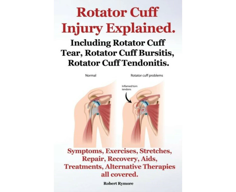 Rotator Cuff Injury Explained. Including Rotator Cuff Tear Rotator Cuff Bursitis Rotator Cuff Tendonitis. Symptoms Exercises Stretches Repair Recovery Aid