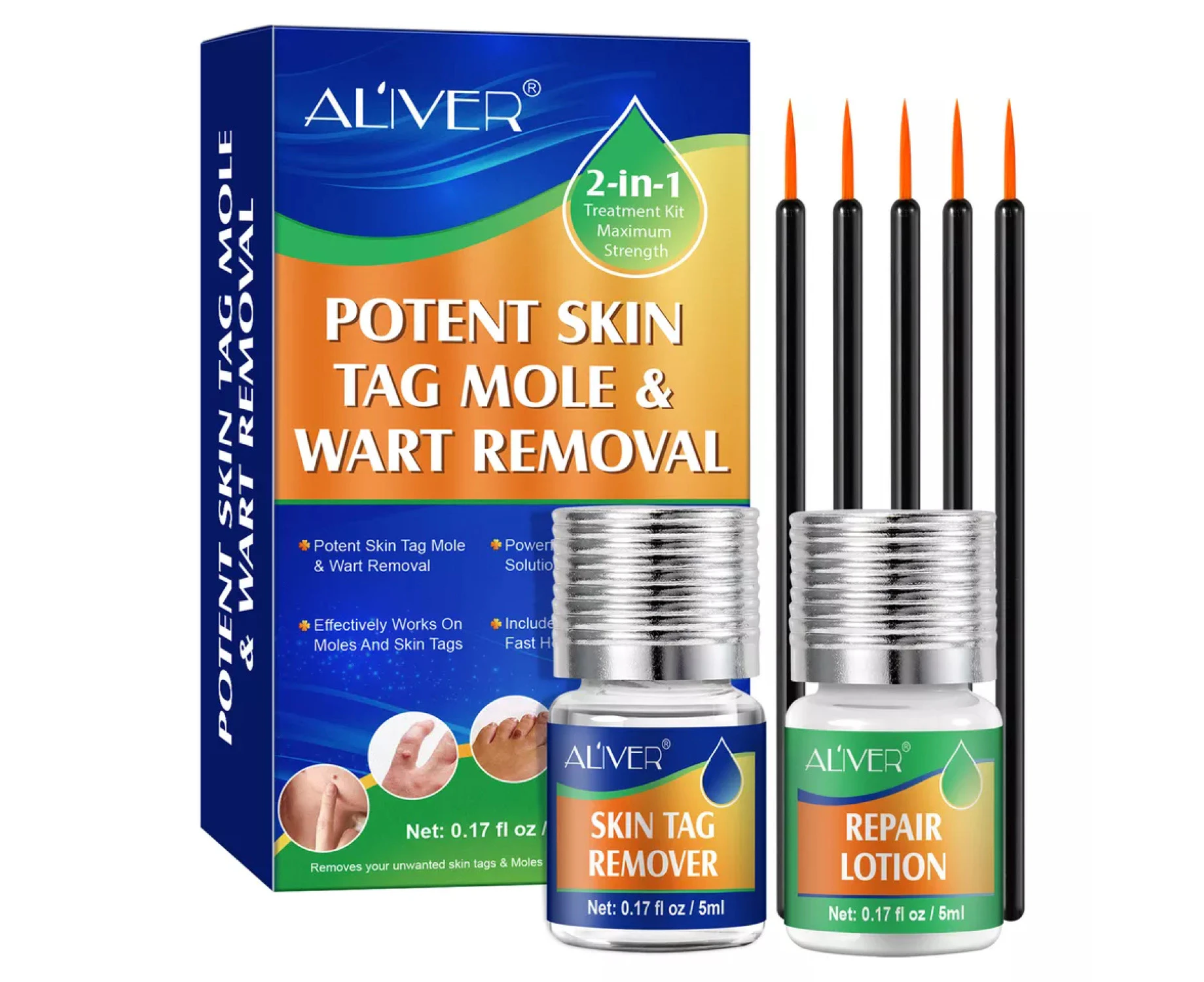 Aliver Gentle Skin Tag Remover Treatment Safe Wart Removal Body Face Liquid Kit Acne Pimple Spot Effective Painless Cream