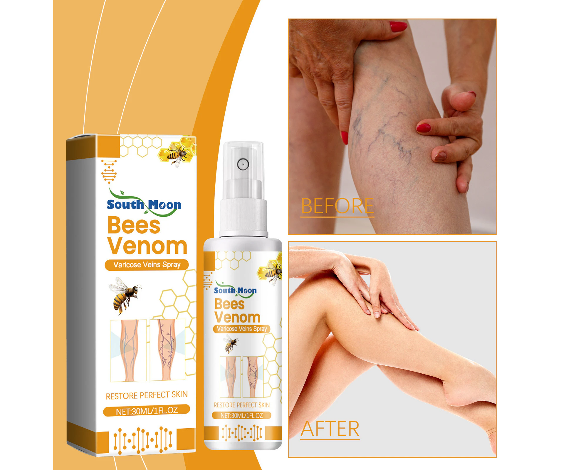 Bee Venom Varicose Veins Spray, Bee Venom Varicose Veins Treatment Spray, Varicose Vein Treatment For Legs, Spider Vein Treatment Spray