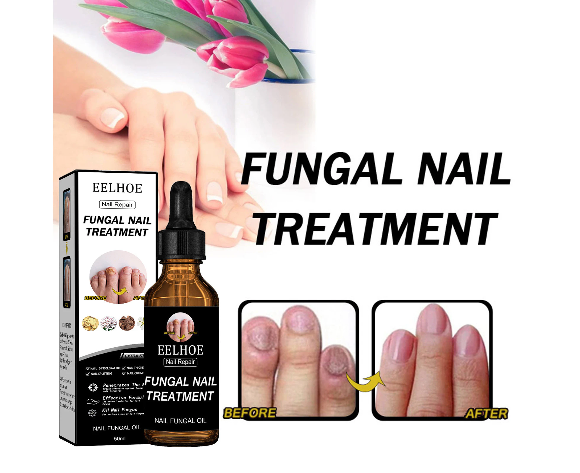 Nail Repair Liquid, Thickening, Brightening, Removing Onychomycosis, Repairing, Moisturizing, Nail Care, Nail Nutrition Care Liquid 50Ml