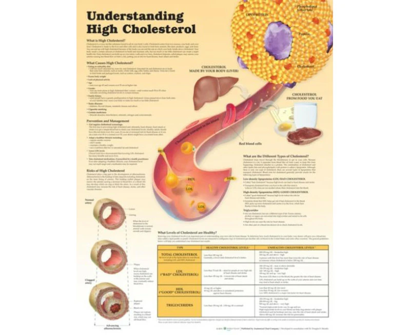 Understanding High Cholesterol Lam by Douglas S. Moodie Anatomical Chart Company