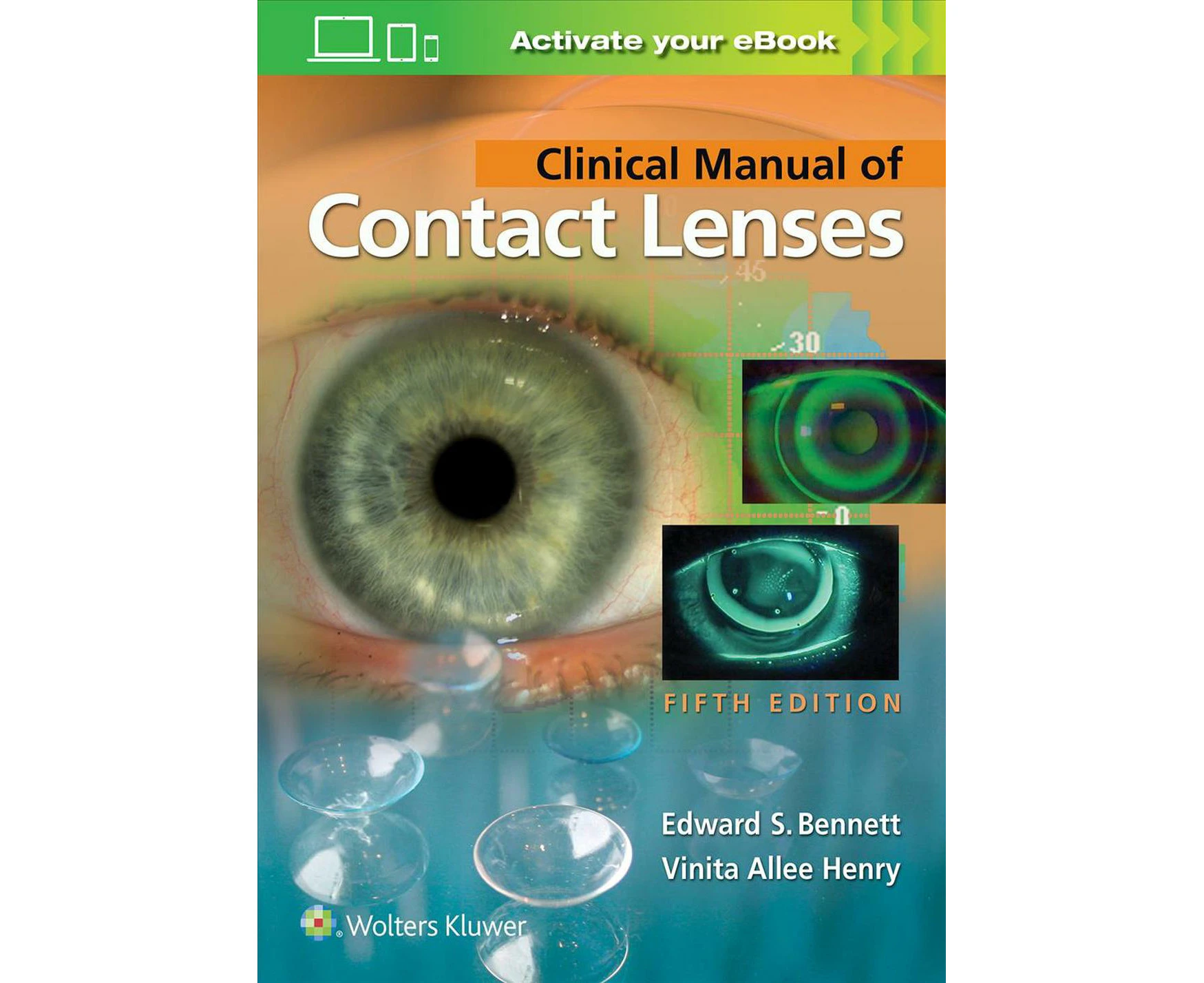 Clinical Manual of Contact Lenses