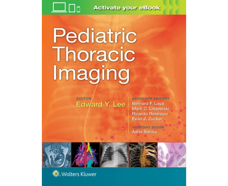 Pediatric Thoracic Imaging by Edward Y. Lee