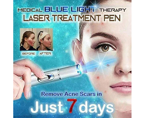 WSECOMM  Venous Disorder Home Treatment Set, Blue Light Therapy Varicose Veins Pen - 1 ct