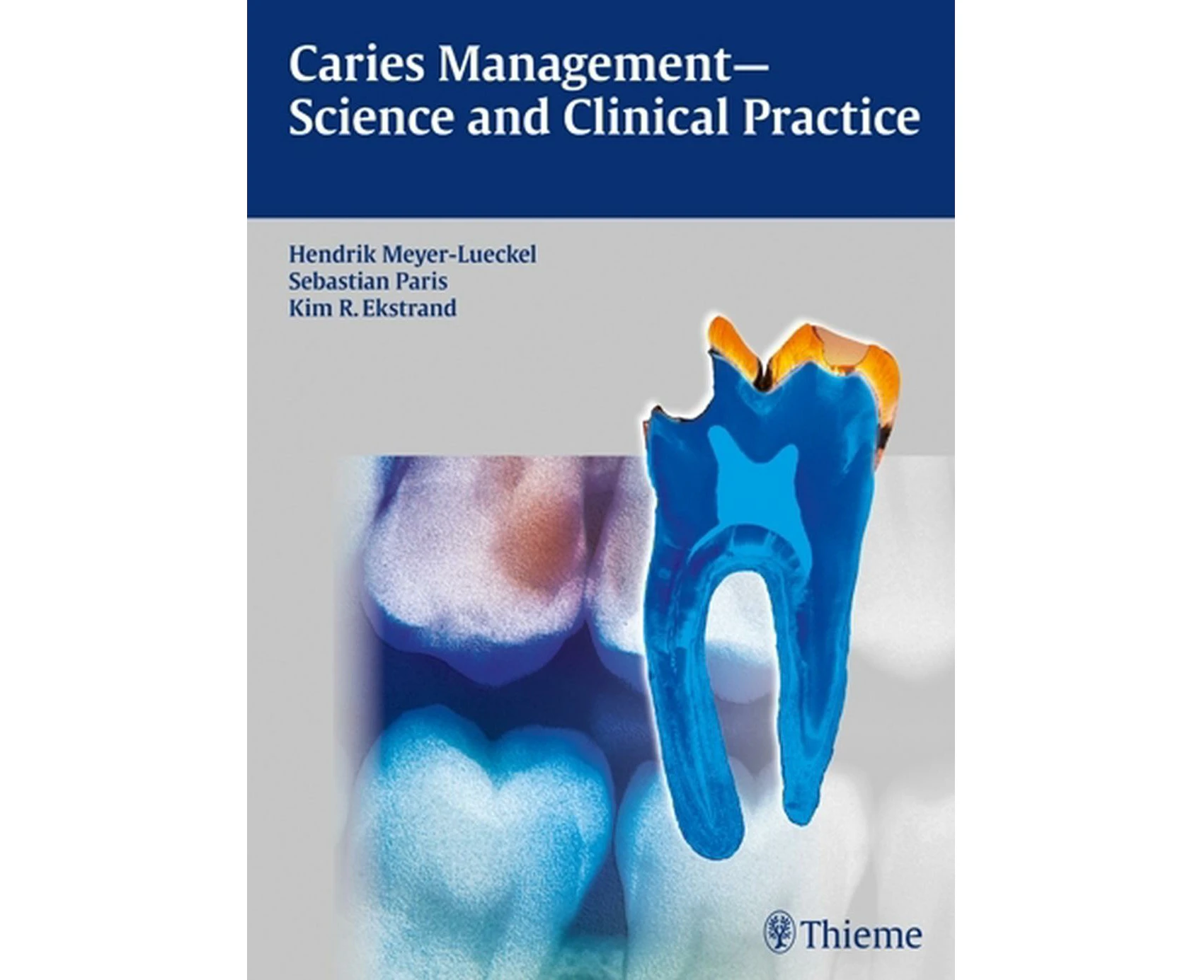 Caries Management - Science and Clinical Practice