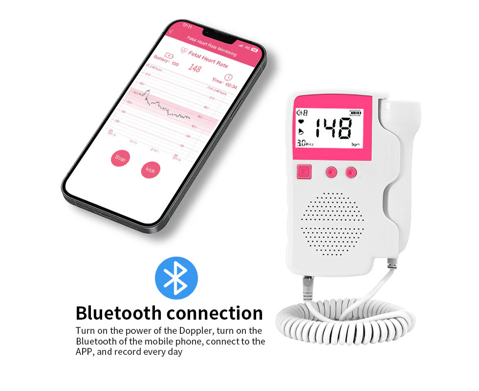 Baby Portable Heart Rate Detector Fetal Doppler,pink-Bluetooth enabled