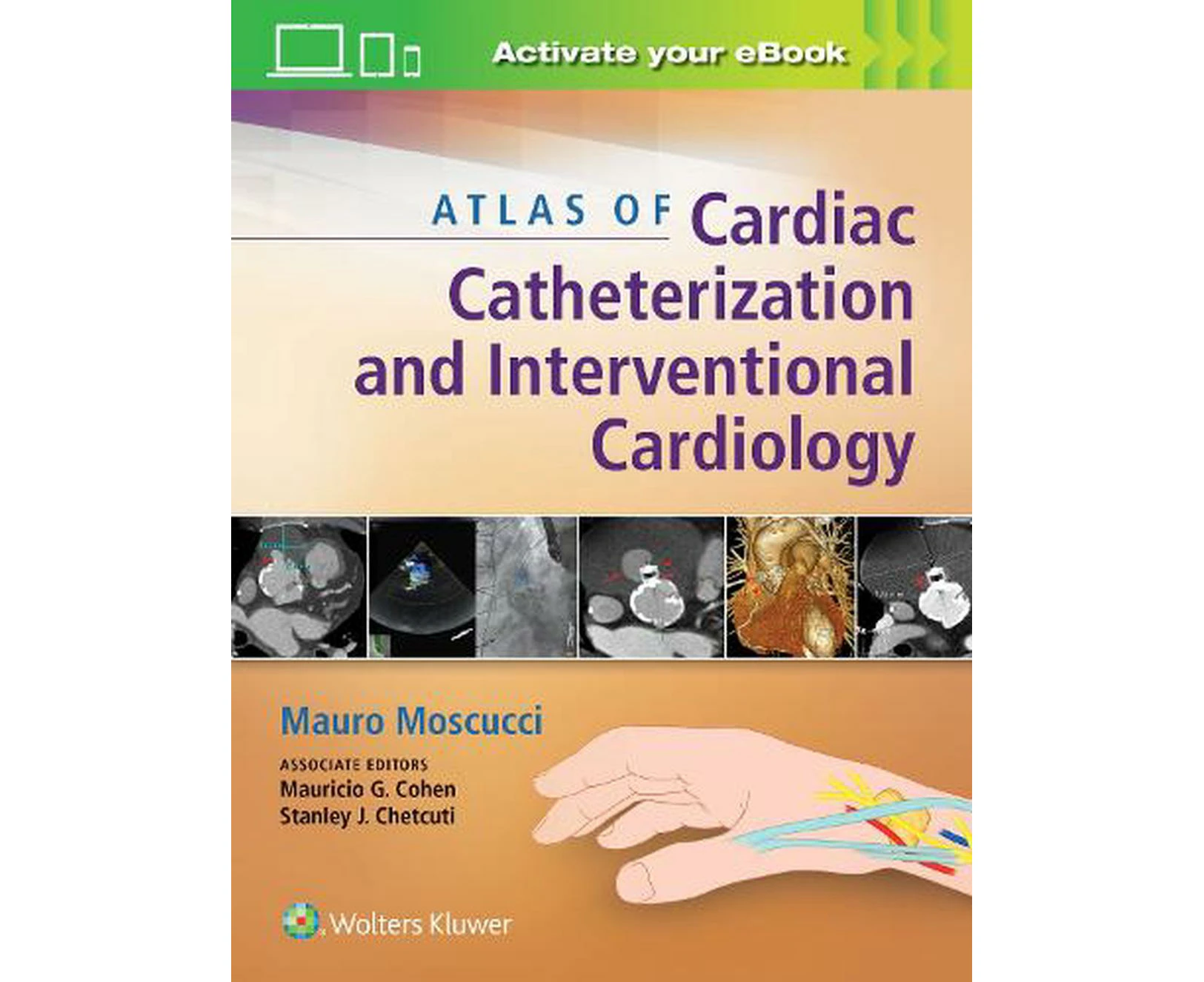 Atlas of Cardiac Catheterization and Interventional Cardiology