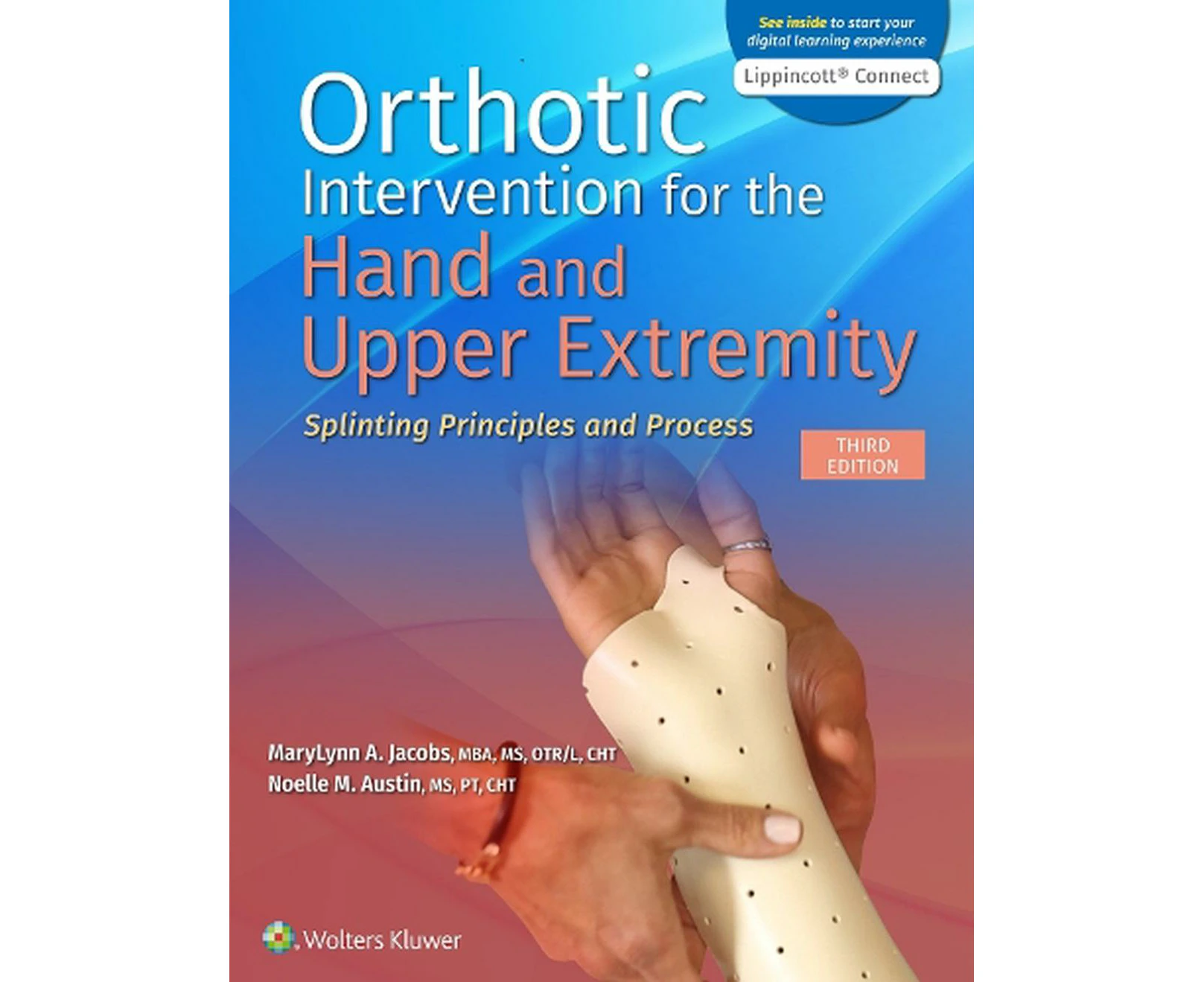 Orthotic Intervention for the Hand and Upper Extremity