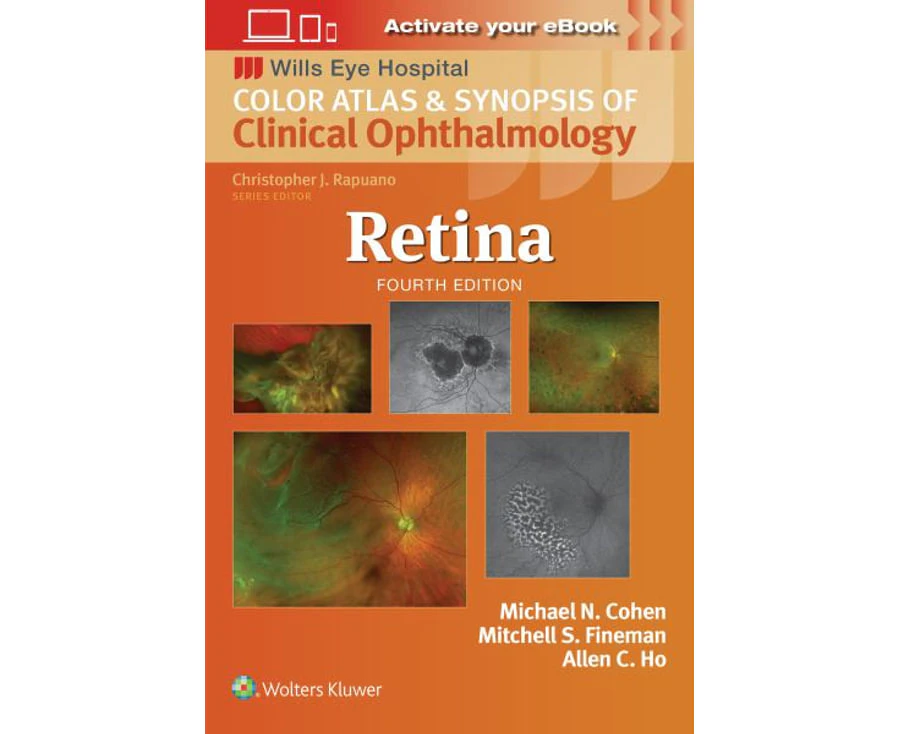 Color Atlas and Synopsis of Clinical Ophthalmology - Retina Wills Eye Institute Atlas Series by Fineman Paperback.