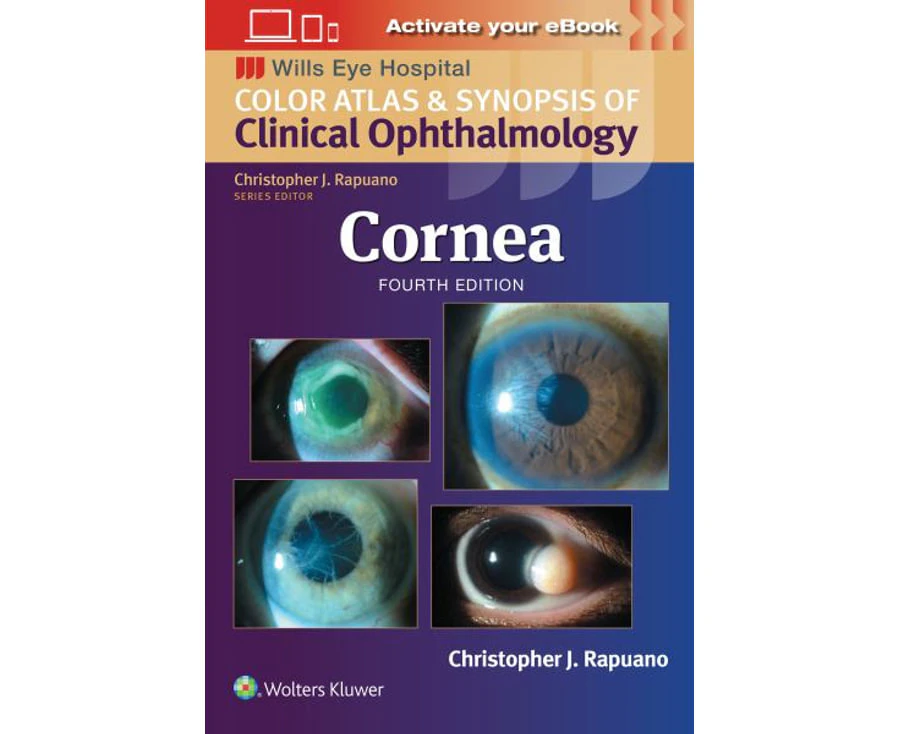 Cornea ( Color Atlas and Synopsis of Clinical Ophthalmology) Wills Eye Institute Atlas Series by Rapuano Paperback.