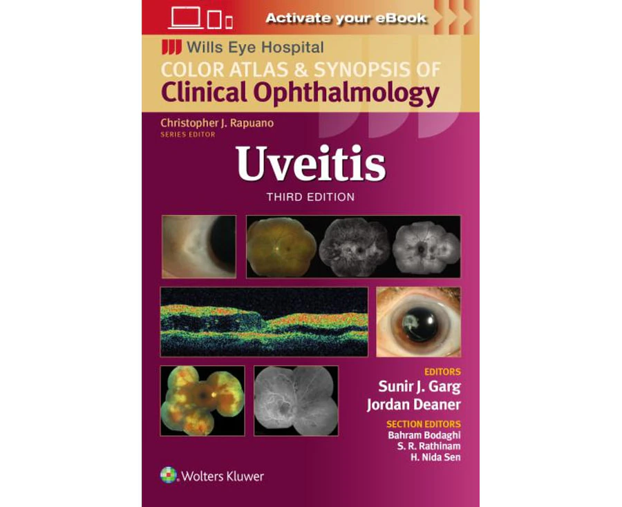 Uveitis Wills Eye Institute Atlas Series by Garg Paperback.